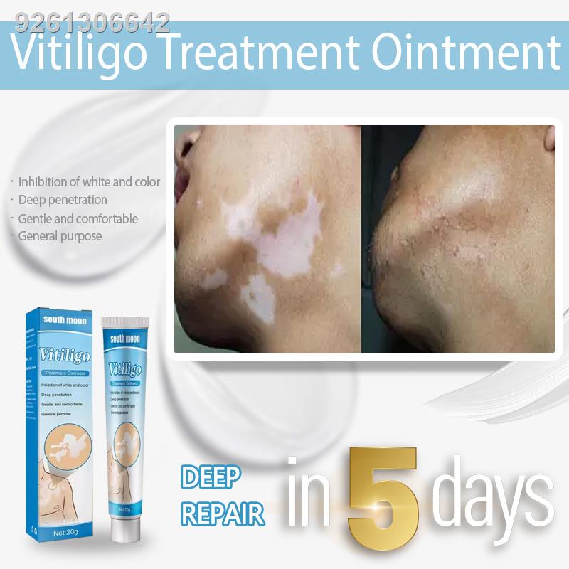 atoderma cream original vitiligo treatment cream vitiligo remover skin