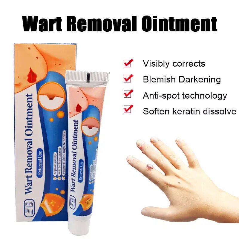 Original Warts Remover Cream Kasoy Cream Mole Warts And Skin Tag Removal Warts Remover Cream