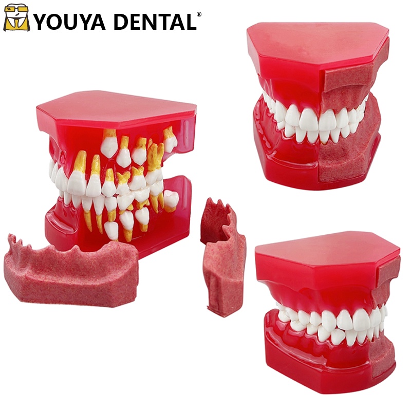 For Studying Teaching Demonstration Dental Model Resin Children Primary ...