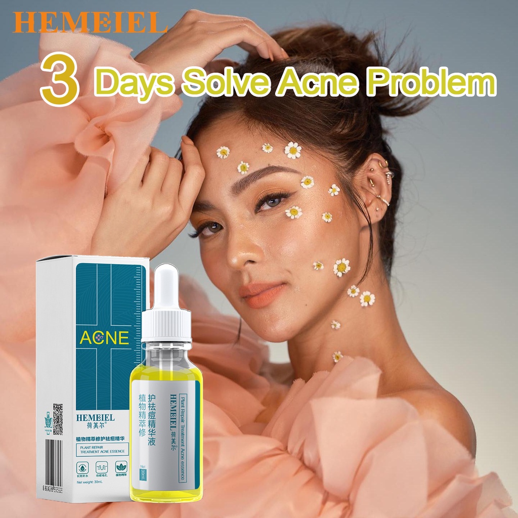 HEMEIEL Pimple Marks Acne Remover/Adapalene Clindamycin/Acne Treatment