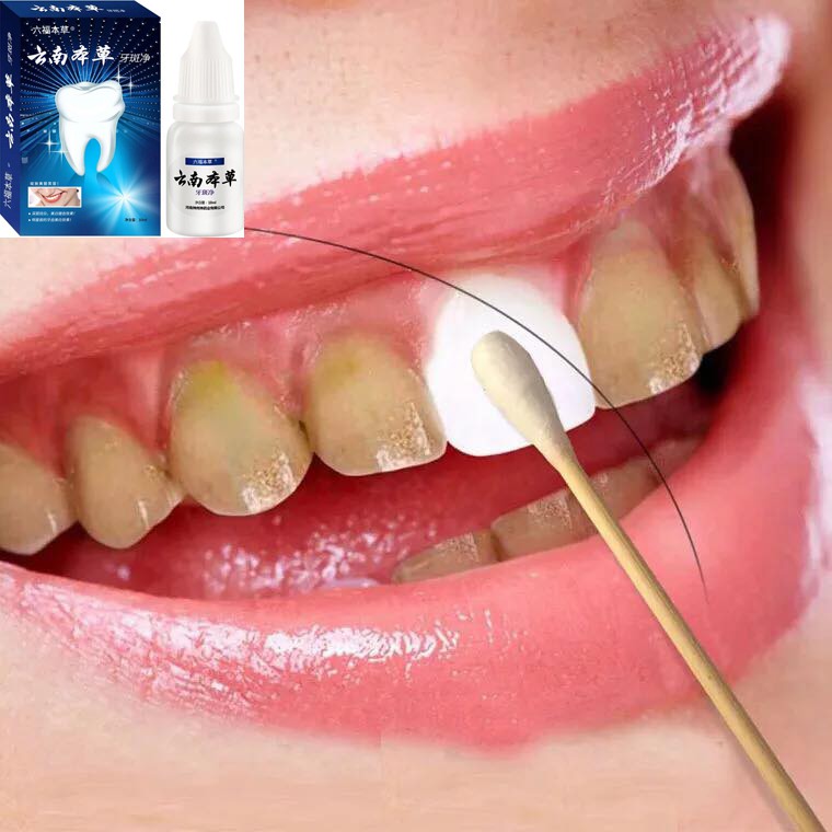 teeth clean Whitening teeth Shopee Philippines