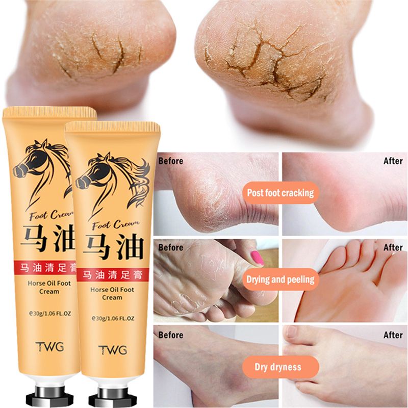 Horse Oil Foot Cream Foot Calluses Removal Balm Foot moisturizing