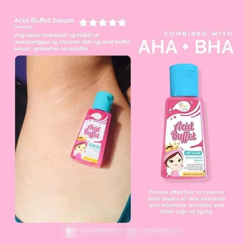 ACID BUFFET BY QUEEN WHITE | Shopee Philippines