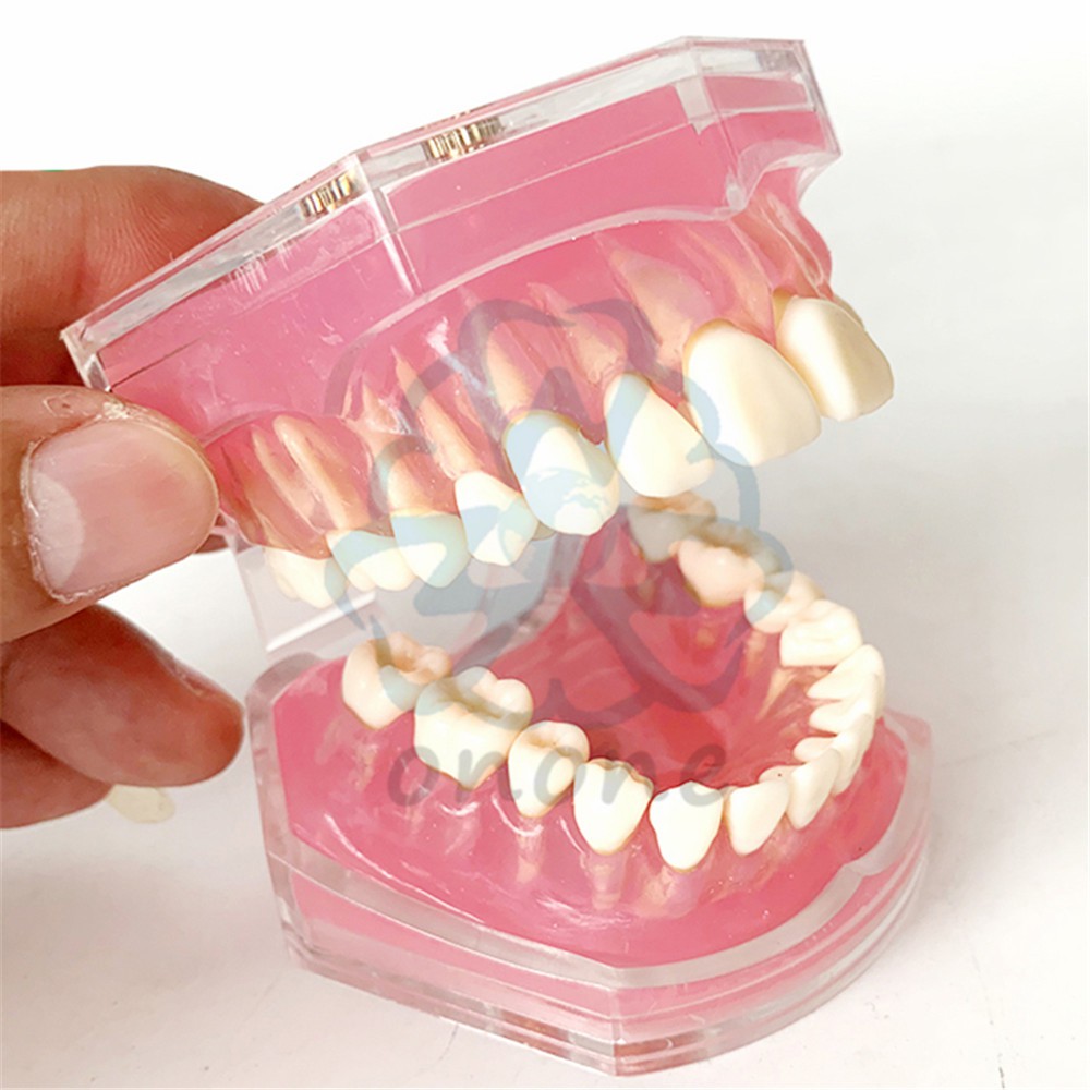 thumbnail image 2 of Dental Flesh Pink Gums Adult Standard Typodont Demonstration Teeth Model – Unbranded 2 of 6