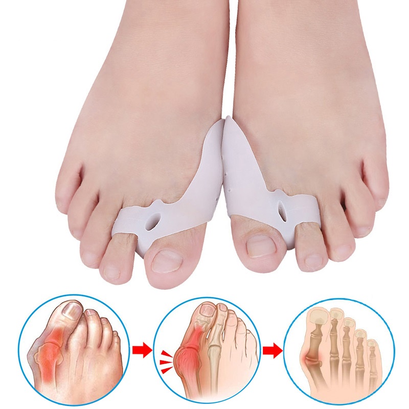 2Pcs Bunion Pad & Toe Spacer Set Gel Toe Separators for Overlapping Toe