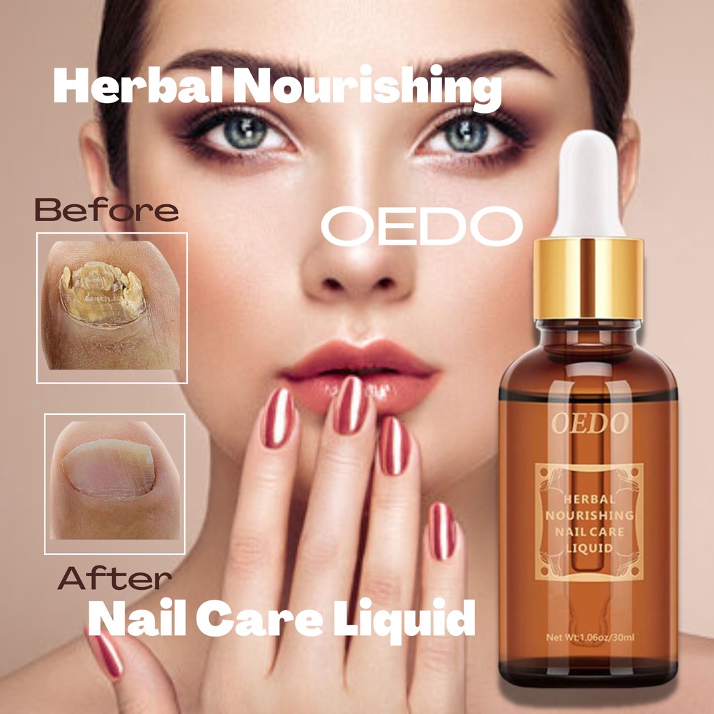 OEDO Nail Repair Essence Serum Fungal Nail Treatment Remove