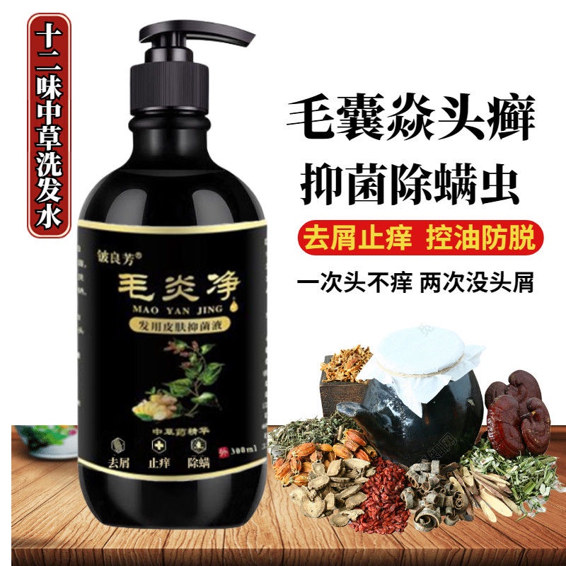 Hair follicle inflammation shampoo, scalp cleansing, tinea capitis ...