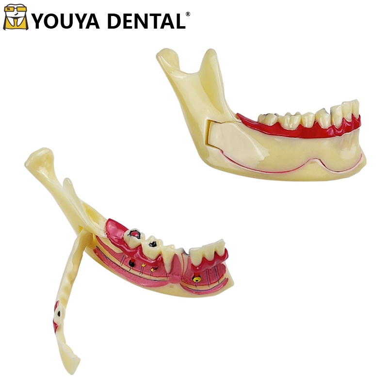Dental Endodontic Treatment Model Right Side Mandible Tissue Anatomical ...