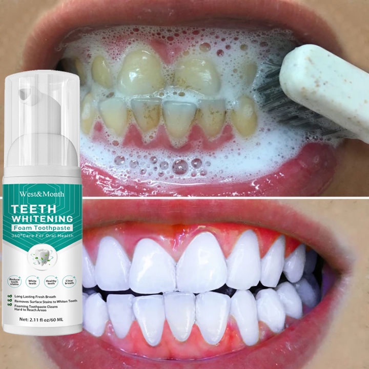 Teeth Whitening Toothpaste Mousse Mouthwash Remove Tartar Oral Care ...