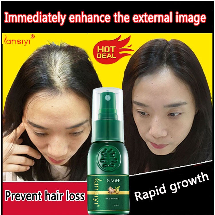 [Hair grows in one spray]LANSIYI Hair Growth Spray 30ml Hair