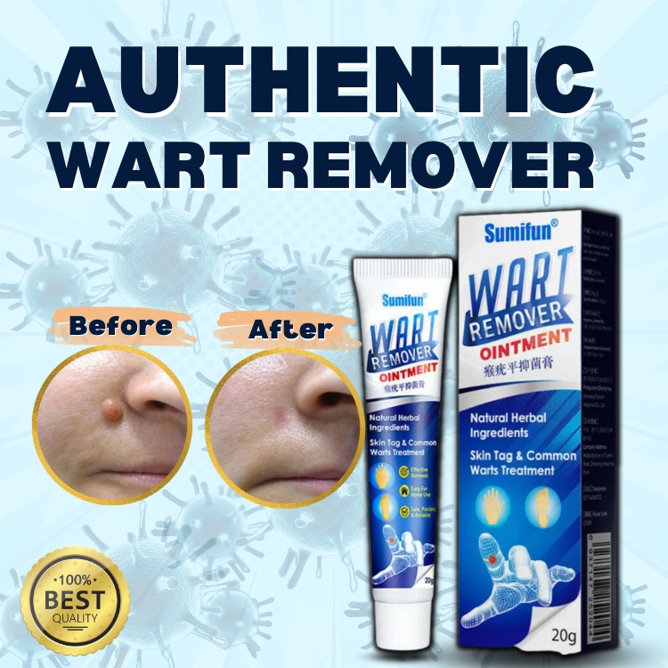 Warts Remover Original Cream Wart Removal Ointment Wart Treatment Skin Tags Mole Remover Cream