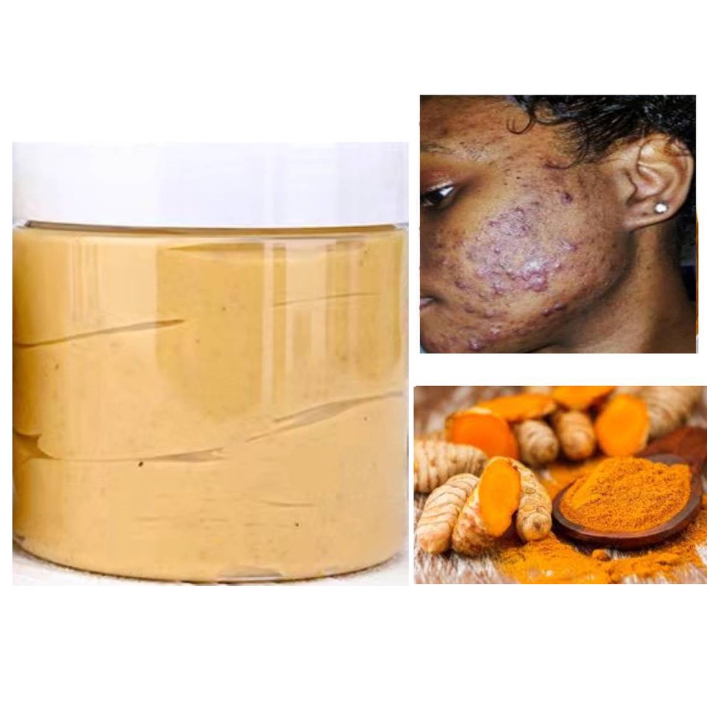 Tumeric Honey Scrub, Acne, Dark Spots, Hyperpigmentation, Smooth Skin