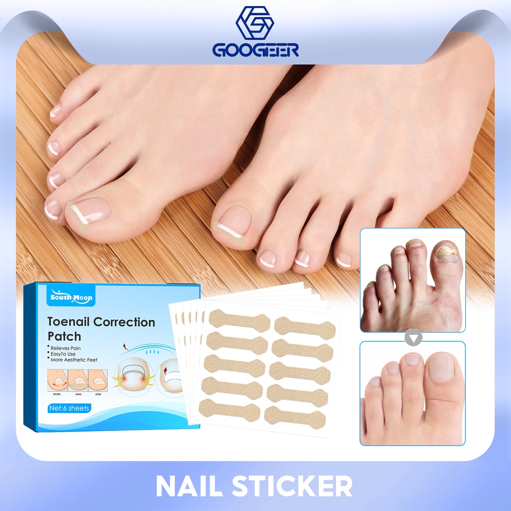 South Moon Toenail Correction Patch Nail Correction Stickers Ingrown