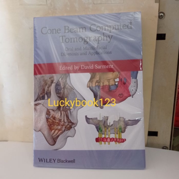 Cone Beam Computed Tomography by David Sarment | Shopee Philippines