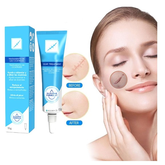 Anti SCAR Stretchmark Keloid SCAR Removal Ointment 100 Original Import Shopee Philippines
