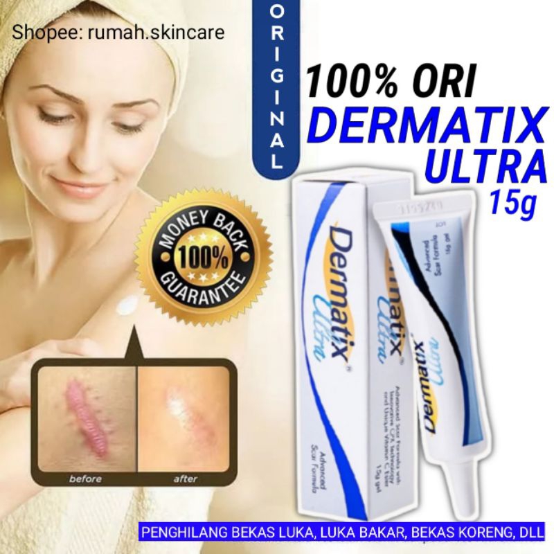 Dermatix Ultra Gel 15g SCAR Removal/Keloid ANTI SCAR Stretchmark 15gram ...