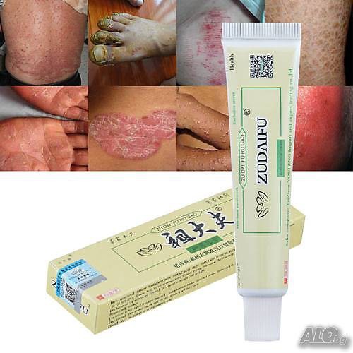 Medicine For Itching Groins Eczema And Fungus Powerful Skin Disease ...