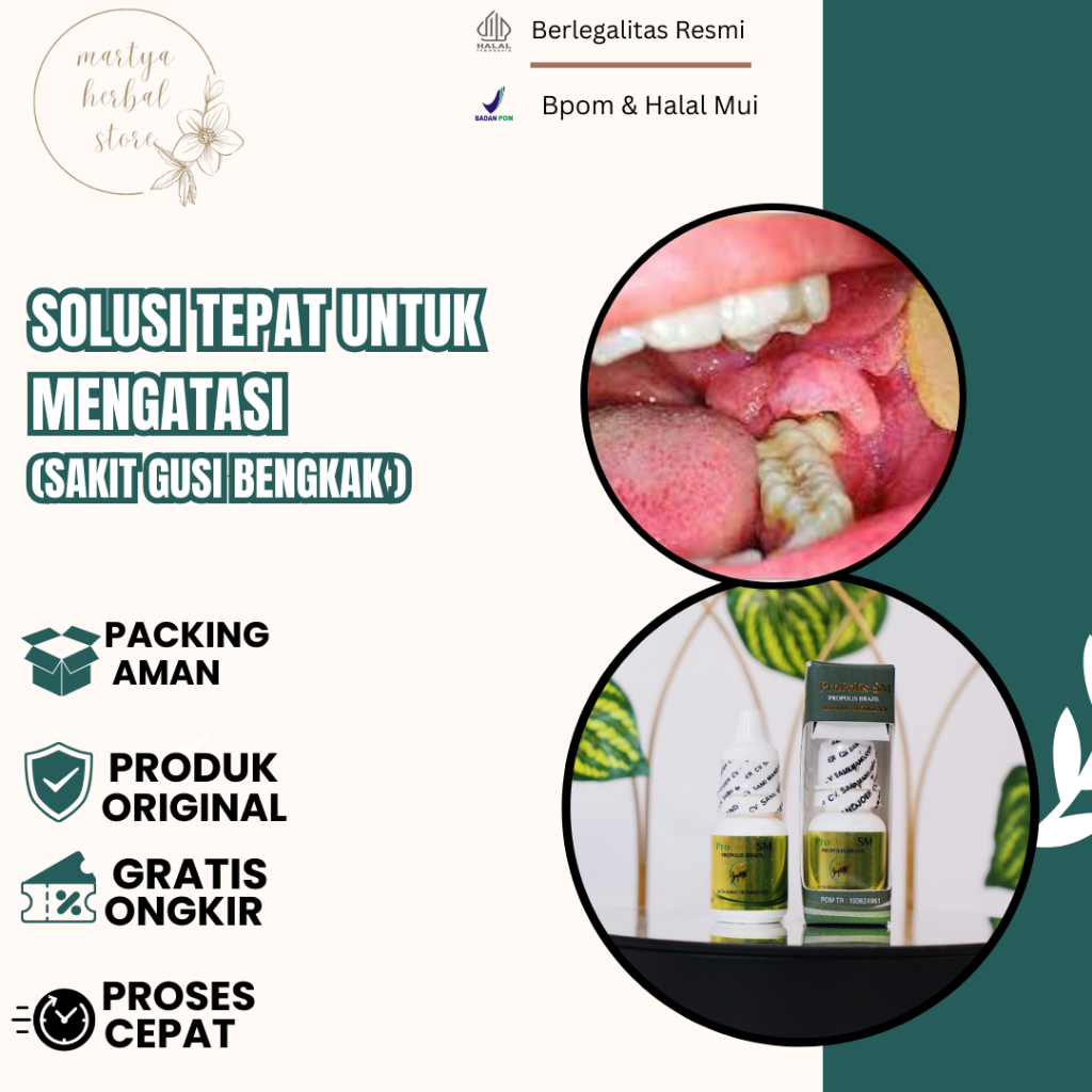 Gum Medicine, Down Gum Medicine, Swelling Gum Medicine, Gum