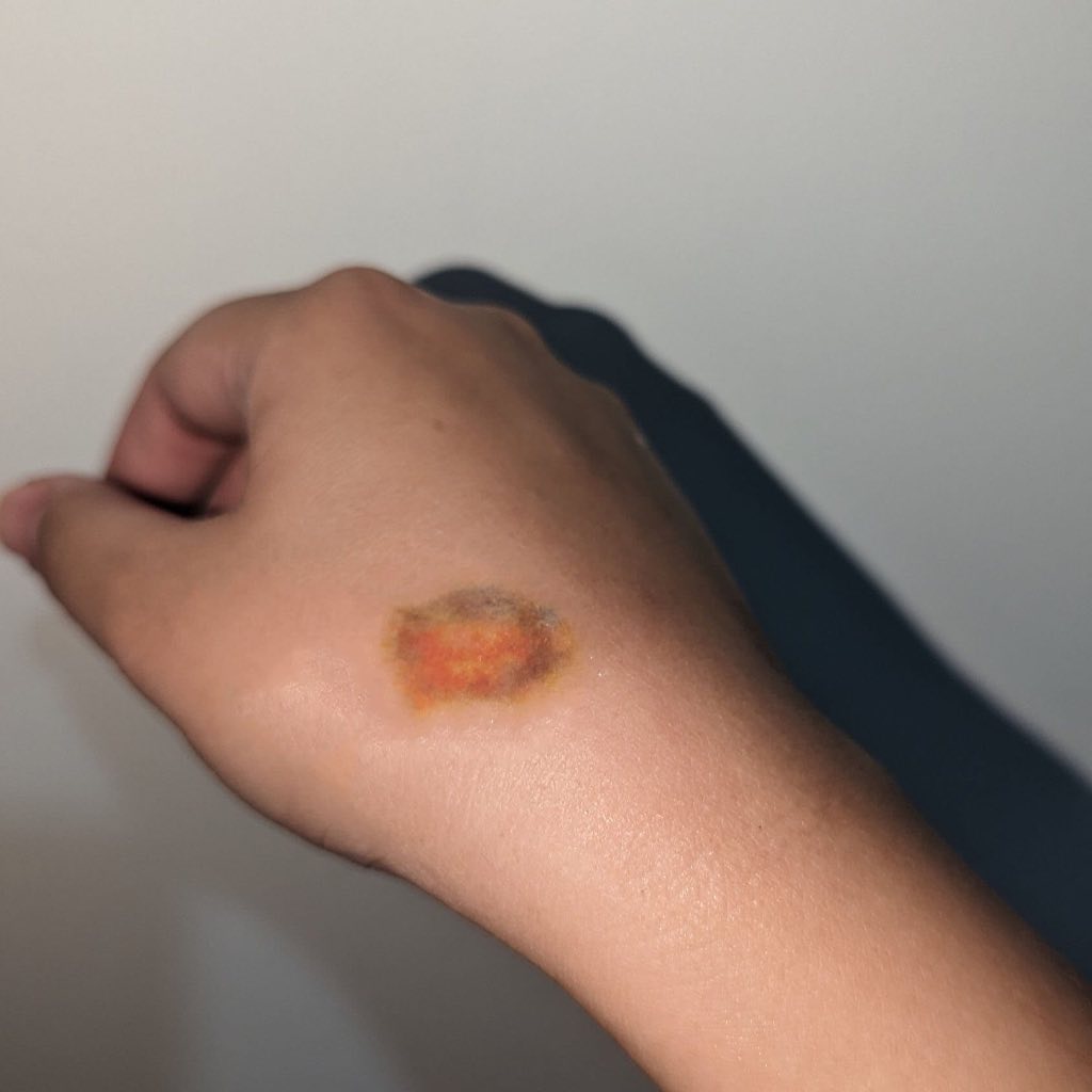 LOKAL [Local Product] Small Bruise Temporary Tattoo | Swelling TATTOO ...