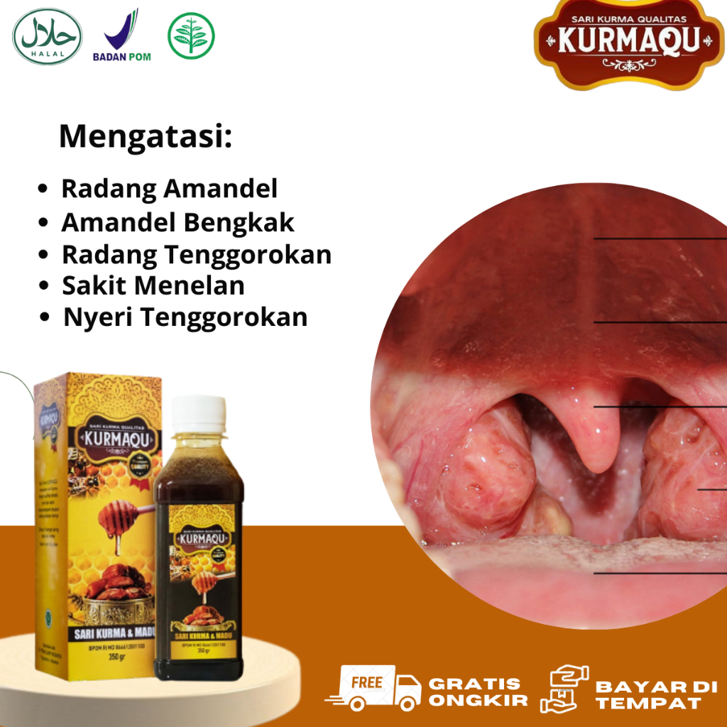 Tonsil Medicine, Child's Tonsil Honey, Adult Tonsil Medicine