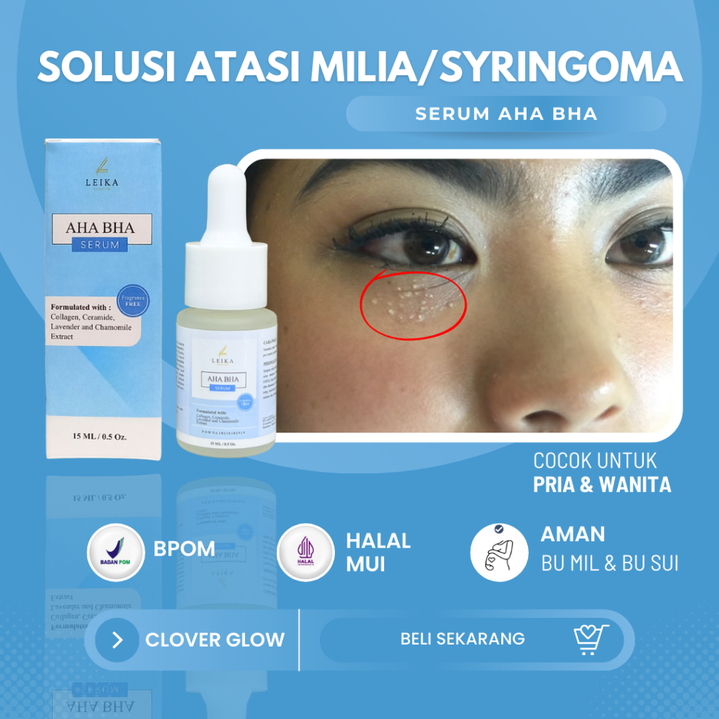 MATA Milia Special Serum Is Very Effective For milia Under