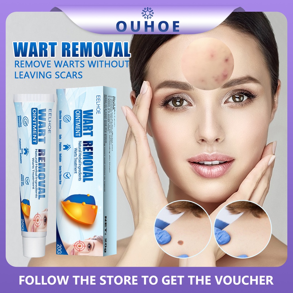 EELHOE Genital Warts Removal Cream Original Mole Removal Skin Tags Mole