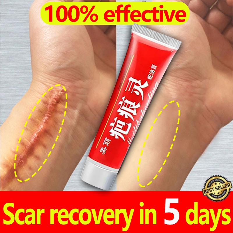 Original Scar Remover Cream Peklat Remover Scar Removal For Old Scars Fades Acne Marks Burn 3351