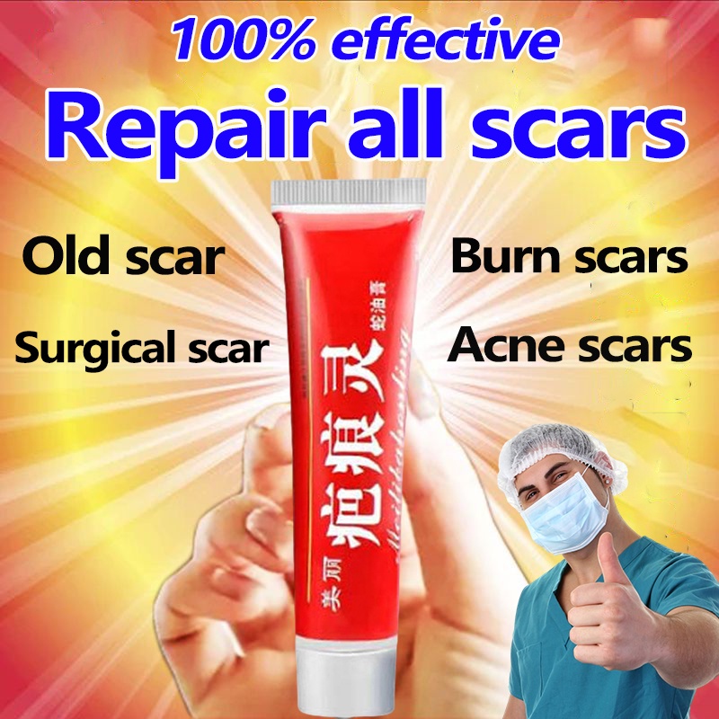 Scar Remover Cream Tanggal peklat Remove Old Scars Burns Acne Stretch