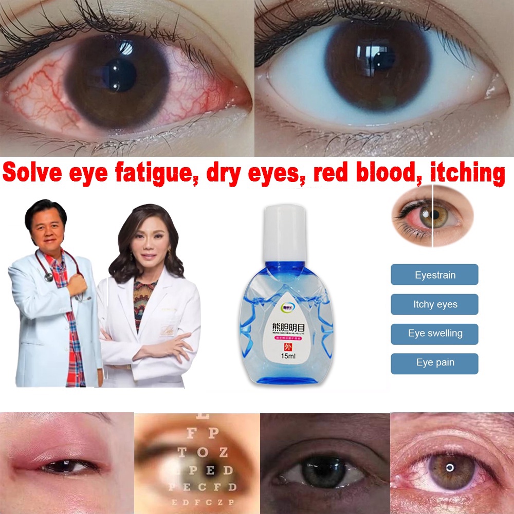 Eye Drops Blurred Vision Cataract Treatment Itchy Relax Fatigue Eyes ...