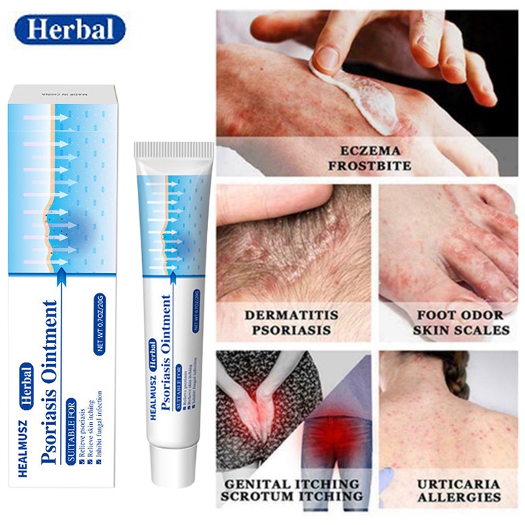 **Antibacterial Psoriasis Cream Anti Itch Eczema Cream Relief Skin Rash ...