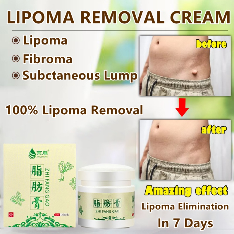 Lipoma Removal Cream 20g Treat Tumor Skin Swelling Ointment Herbal Lipoma Cream Original Japan 