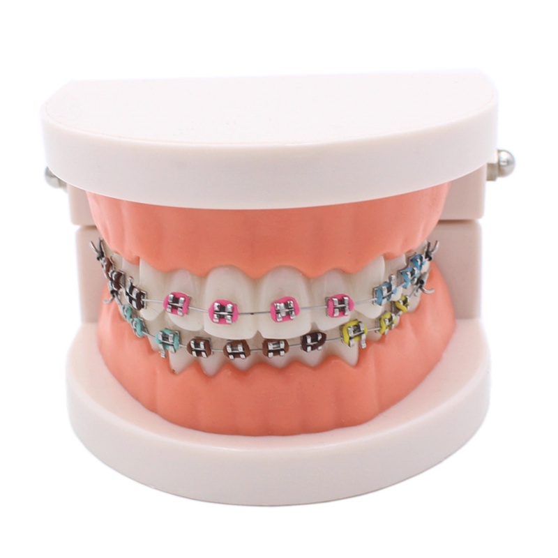 Dental Orthodontic Treatment Model With Ortho Metal Ceramic Bracket