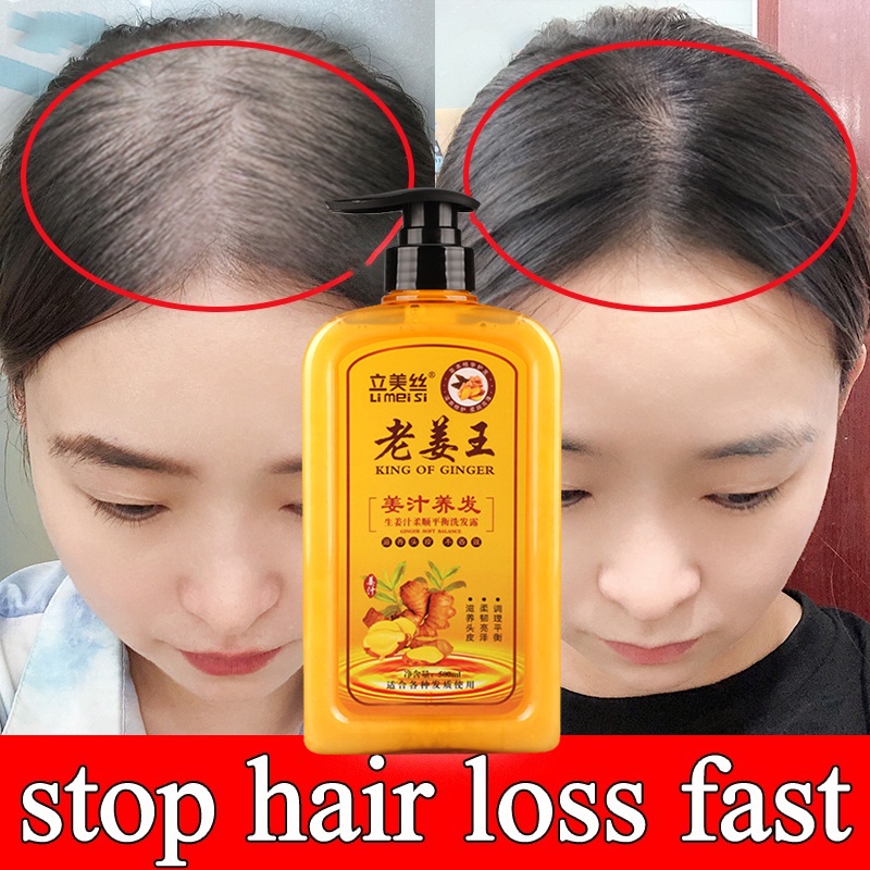 YANJIAYI 500ML Ginger Shampoo Anti Hair Loss Fast Hair Growth Shampoo