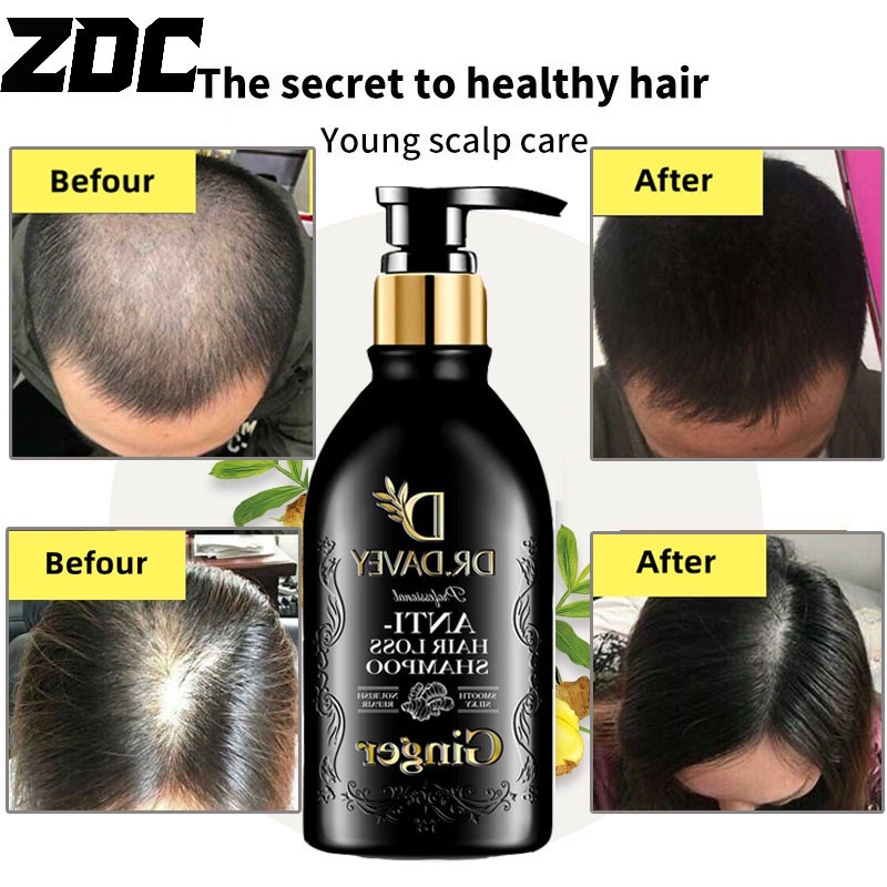 ZDC Ginger Emperor Shampoo Anti-Hair Loss Oil Control Ginger Nourishing ...