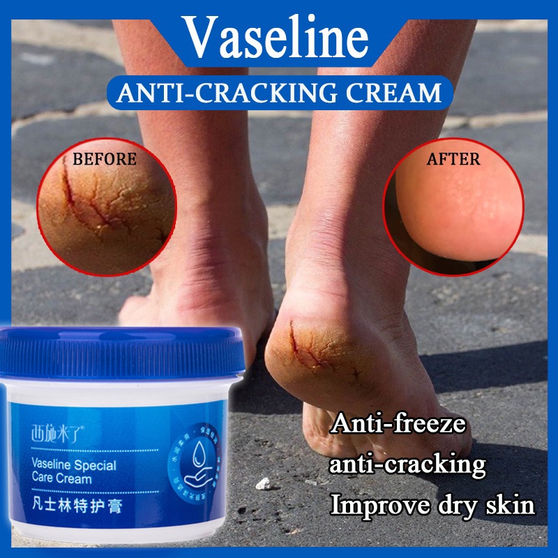 Vaseline Anti Cracking Foot Cream Anti Chapped Moisturizing Hand Cream For Dry Chappe Hand Foot