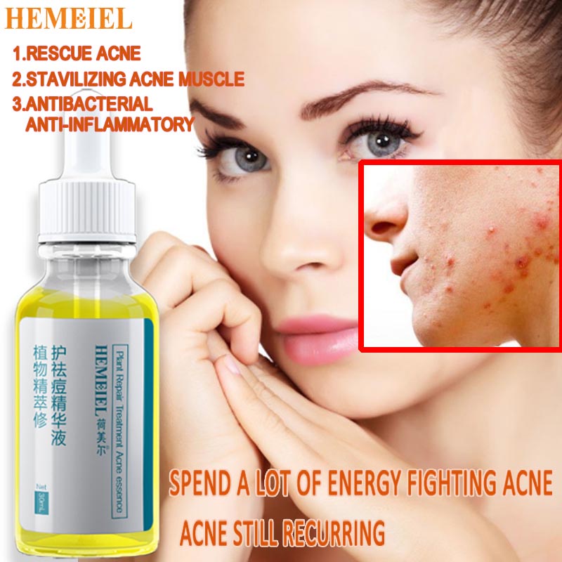 HEMEIEL Pimple Marks Acne Remover/Adapalene Clindamycin/Acne Treatment