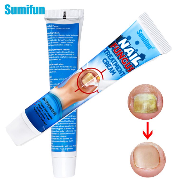 Sumifun Nail Fungus Treatment Cream Onychomycosis Removal Ointment