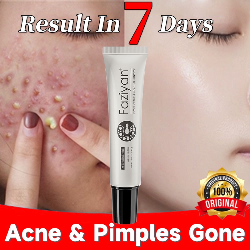 Pimple Marks Remover Cream Anti Acne Effective Acne Scar Remover Cream
