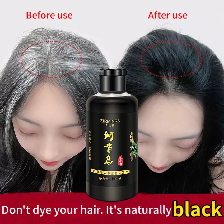 Polygonum Multiflorum Black Hair Shampoo Ginseng Extract Nourishing ...