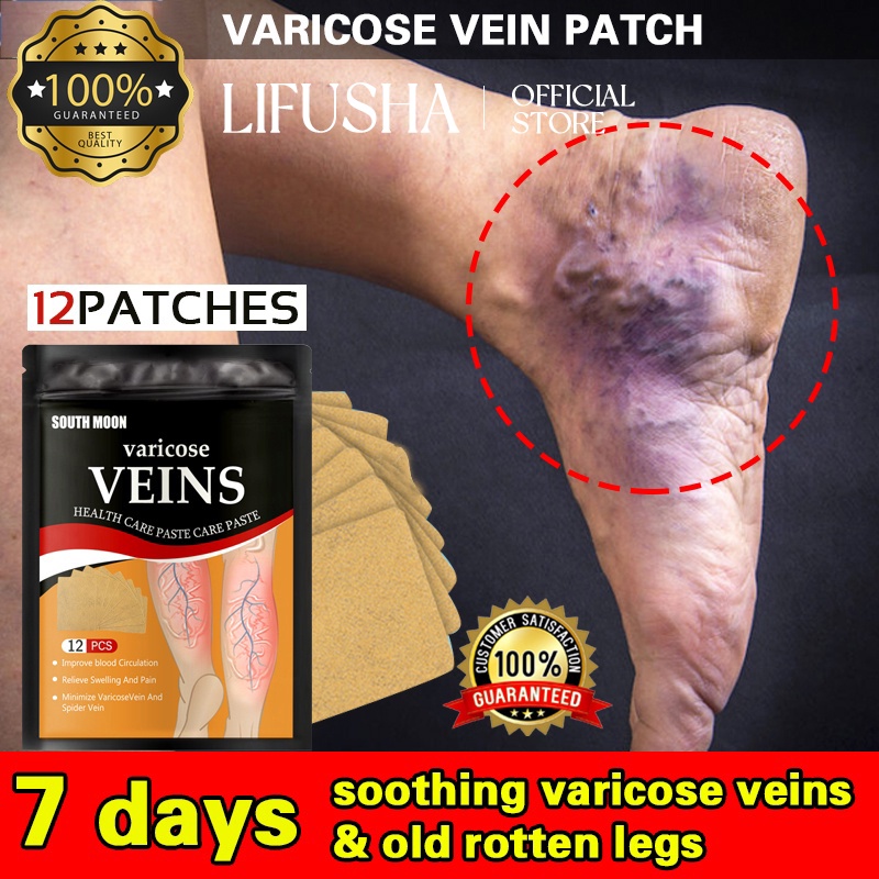 LIFUSHA 12PCS Varicose Vein Patch Herbal Plaster Varicose Veins Remover