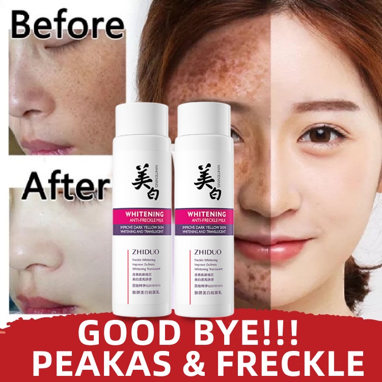 Whitening Niacinamide Freckle Cream Hydrating Moisturizing Lotion ...