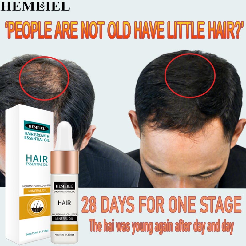 HEMEIEL Novu Hair Grower Pomade For Men Original/Hair Growth Serum Oil ...