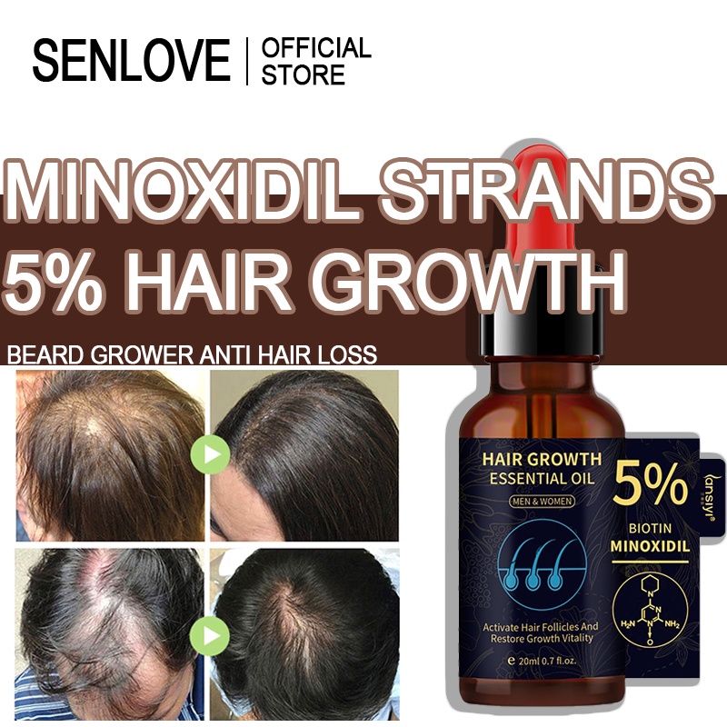 Minoxidil 5% Hair Growth Essential Oil Ginger Hair Nutrient Solution ...