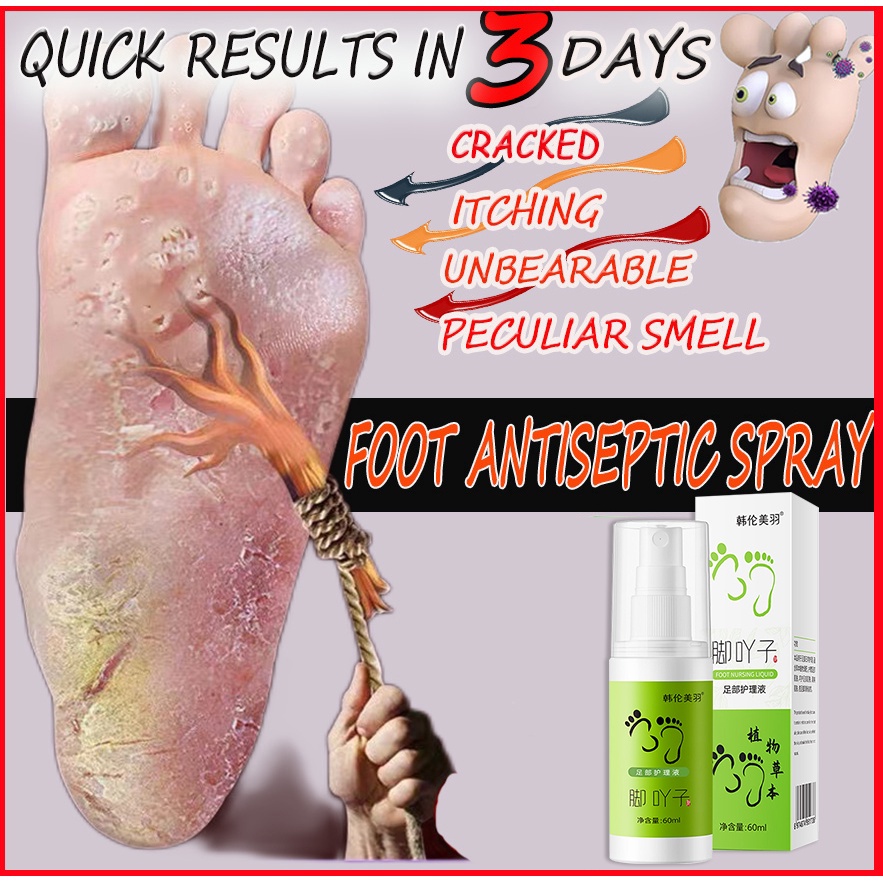 Foot Deodorant Spray Anti Odor Anti Sweat Beriberi Antibacterial Foot