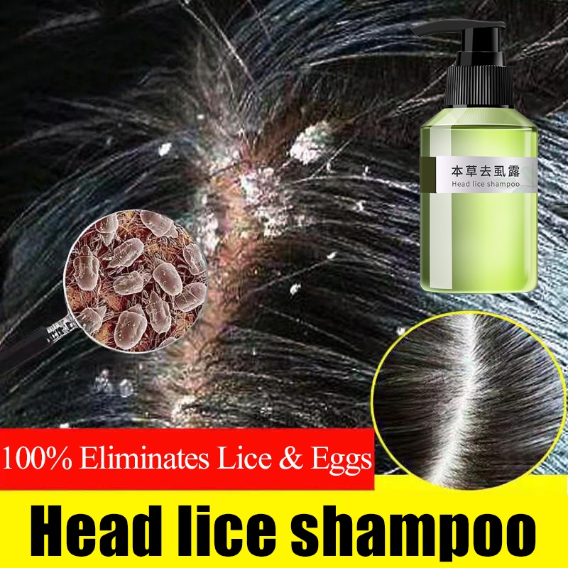 head-lice-aliz-remover-shampoo-for-adult-kids-removal-licealiz-eggs-for