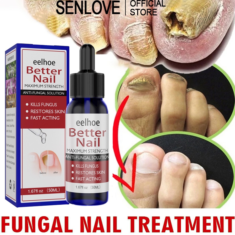 50ML Nail Repair Essence Serum Fungal Nail Treatment Anti Fungal Nail
