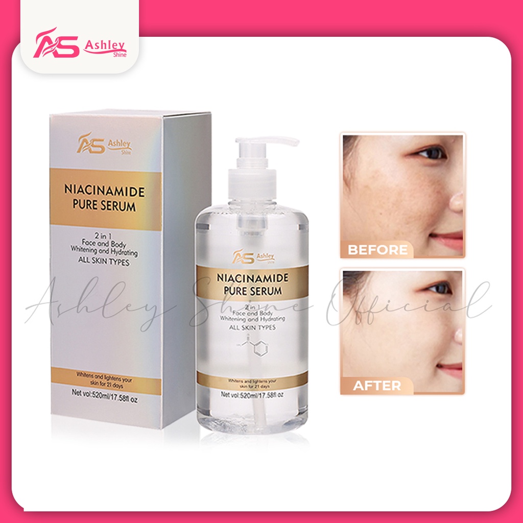 Ashley Shine NIACINAMIDE Pure Serum Face and Body Moisturizes Whitening ...