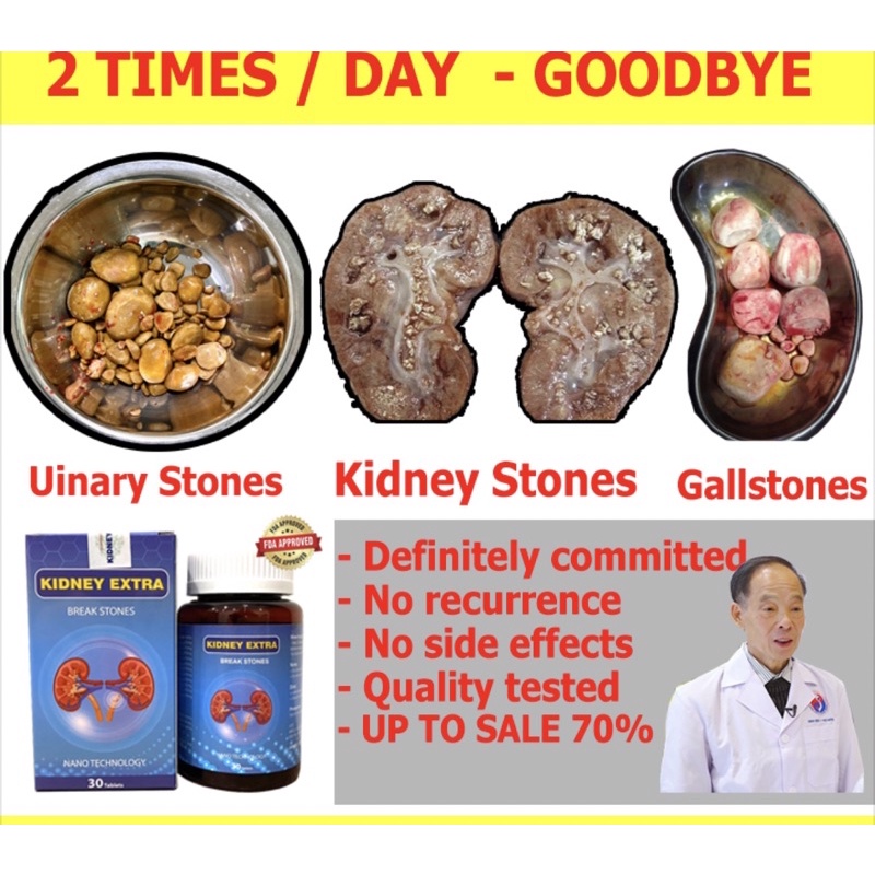 KIDNEY EXTRA BREAKSTONES 30 tablets Shopee Philippines