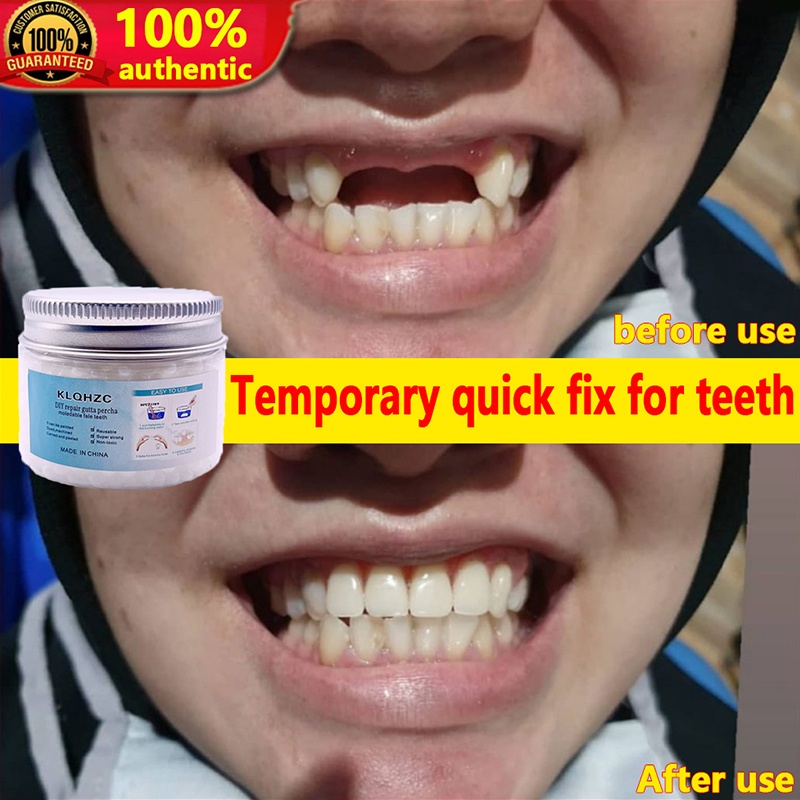 DIY Tooth Repair Kit Temporary Teeth Restoration Moldable Falseteeth