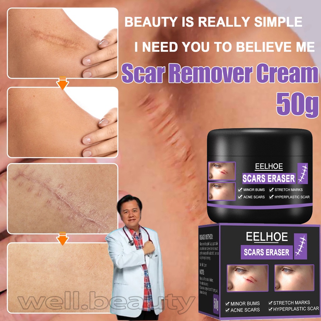 Scar Remover Cream Original Remover Acne Stretch Mark For All Scars Skin Care Peklat Remover 9345